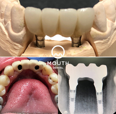 Patient Case